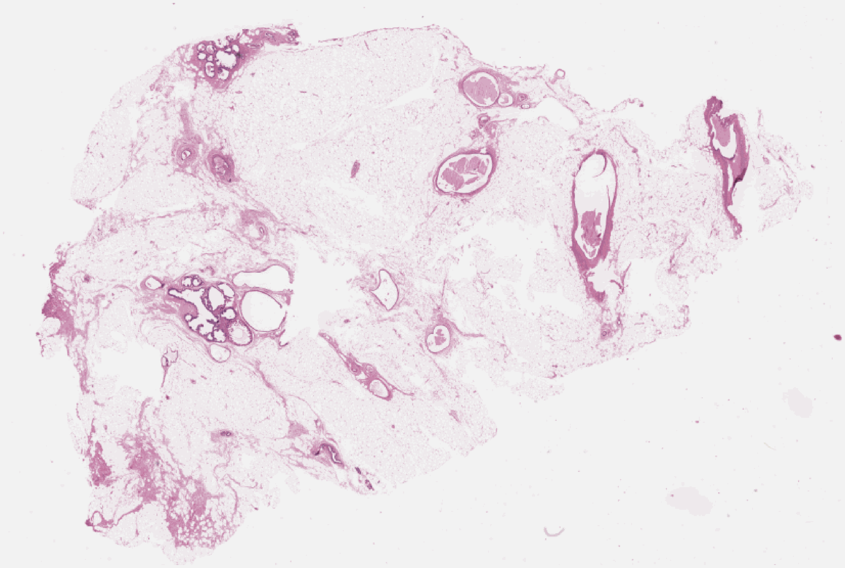 Illustration of AI cancer diagnostics